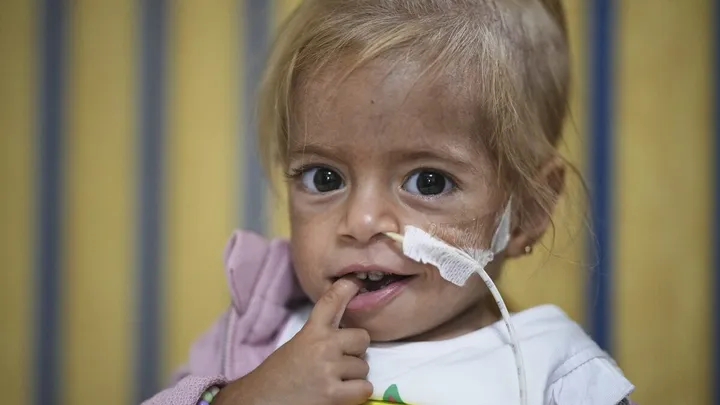 Image 15: Senyum Bayi Malanutrisi yang Dievakuasi dari Gaza
