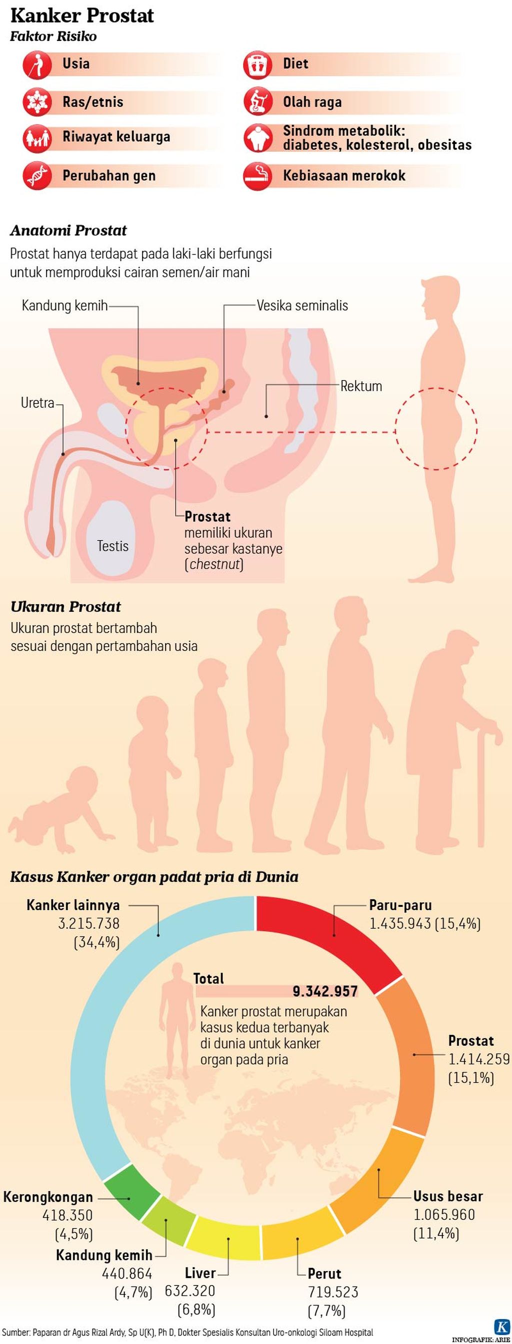 https://assetd.kompas.id/psSWCg0UCXqlnUJaLlzCLlPdXgQ=/1024x2688/https%3A%2F%2Fasset.kgnewsroom.com%2Fphoto%2Fpre%2F2021%2F09%2F06%2F20210906-H08-ANU-kanker-prostat-mumed-01_1630944517_jpg.jpg